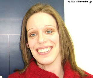 Marie-Hélène Cyr - After orthodontic treatments and orthognathic surgeries (February 10, 2009)